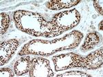 TSPY3 Antibody in Immunohistochemistry (Paraffin) (IHC (P))