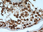 TSPY3 Antibody in Immunohistochemistry (Paraffin) (IHC (P))