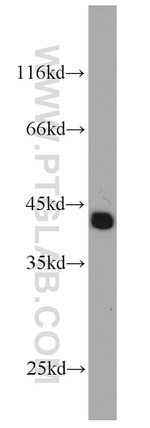 TSPY3 Antibody in Western Blot (WB)