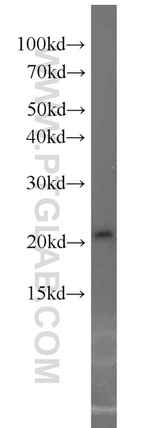 ASF1A Antibody in Western Blot (WB)