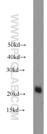 ASF1A Antibody in Western Blot (WB)