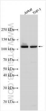 ESPL1 Antibody in Western Blot (WB)