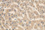 APOC3 Antibody in Immunohistochemistry (Paraffin) (IHC (P))