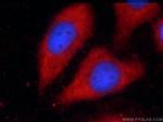 VAMP7/TI-VAMP Antibody in Immunocytochemistry (ICC/IF)