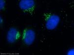 Giantin Antibody in Immunocytochemistry (ICC/IF)