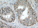 CALML6 Antibody in Immunohistochemistry (Paraffin) (IHC (P))
