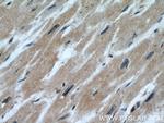 CALML6 Antibody in Immunohistochemistry (Paraffin) (IHC (P))
