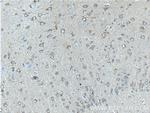 CACNA1D Antibody in Immunohistochemistry (Paraffin) (IHC (P))