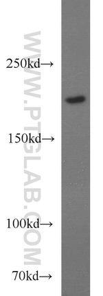 CACNA1S Antibody in Western Blot (WB)
