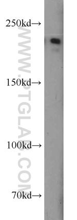 CACNA1S Antibody in Western Blot (WB)