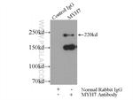 MYH7 Antibody in Immunoprecipitation (IP)
