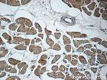 MYH6 Antibody in Immunohistochemistry (Paraffin) (IHC (P))