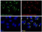 CLTCL1 Antibody in Immunocytochemistry (ICC/IF)