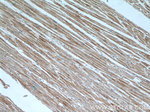 CLTCL1 Antibody in Immunohistochemistry (Paraffin) (IHC (P))
