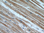CLTCL1 Antibody in Immunohistochemistry (Paraffin) (IHC (P))
