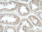 CLTCL1 Antibody in Immunohistochemistry (Paraffin) (IHC (P))