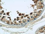 CLTCL1 Antibody in Immunohistochemistry (Paraffin) (IHC (P))