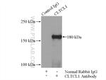 CLTCL1 Antibody in Immunoprecipitation (IP)
