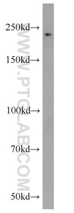 CLTCL1 Antibody in Western Blot (WB)