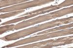 MYH13 Antibody in Immunohistochemistry (Paraffin) (IHC (P))