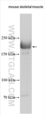 MYH15 Antibody in Western Blot (WB)
