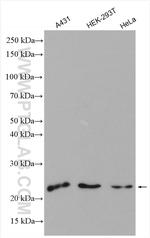SAR1A Antibody in Western Blot (WB)