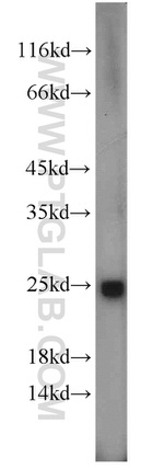 SAR1A Antibody in Western Blot (WB)