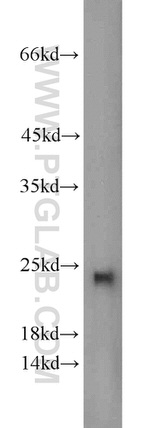 SAR1A Antibody in Western Blot (WB)