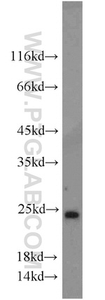 SAR1A Antibody in Western Blot (WB)