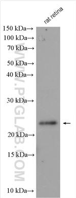 GCAP2 Antibody in Western Blot (WB)