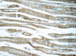 CCL18/MIP-4 Antibody in Immunohistochemistry (Paraffin) (IHC (P))