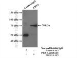PBX4 Antibody in Immunoprecipitation (IP)