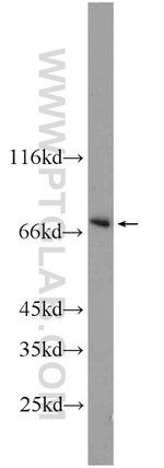 PBX4 Antibody in Western Blot (WB)