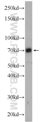 PBX4 Antibody in Western Blot (WB)