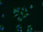 RCC1 Antibody in Immunocytochemistry (ICC/IF)