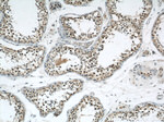 RCC1 Antibody in Immunohistochemistry (Paraffin) (IHC (P))