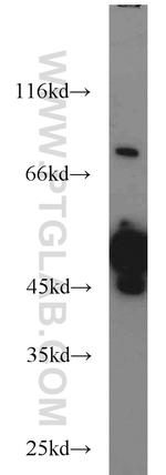 RCC1 Antibody in Western Blot (WB)