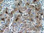 P glycoprotein Antibody in Immunohistochemistry (Paraffin) (IHC (P))