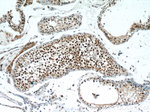 TCF4 Antibody in Immunohistochemistry (Paraffin) (IHC (P))