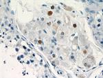 TCF4 Antibody in Immunohistochemistry (Paraffin) (IHC (P))