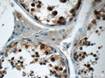 USP11 Antibody in Immunohistochemistry (Paraffin) (IHC (P))