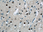 USP11 Antibody in Immunohistochemistry (Paraffin) (IHC (P))