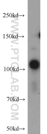 USP11 Antibody in Western Blot (WB)