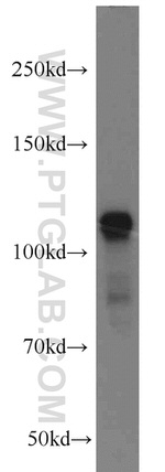 USP11 Antibody in Western Blot (WB)