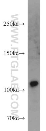 USP11 Antibody in Western Blot (WB)