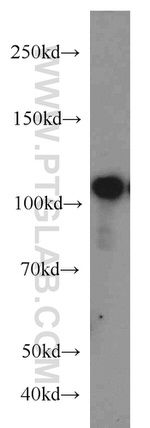 USP11 Antibody in Western Blot (WB)