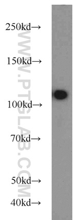 USP11 Antibody in Western Blot (WB)