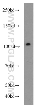 USP11 Antibody in Western Blot (WB)