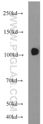 USP11 Antibody in Western Blot (WB)