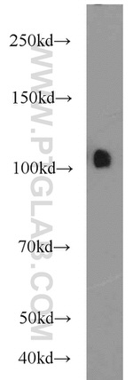 USP11 Antibody in Western Blot (WB)
